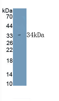 Polyclonal Antibody to Connective Tissue Growth Factor (CTGF)