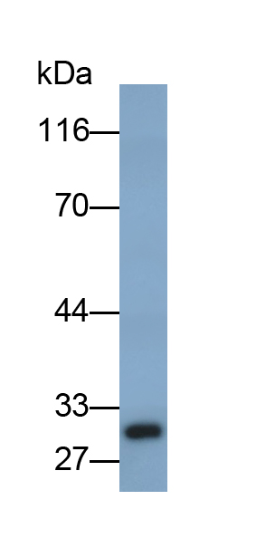 Polyclonal Antibody to Brain Derived Neurotrophic Factor (BDNF)