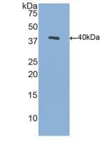 Polyclonal Antibody to Brain Derived Neurotrophic Factor (BDNF)