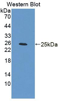 Polyclonal Antibody to Brain Derived Neurotrophic Factor (BDNF)