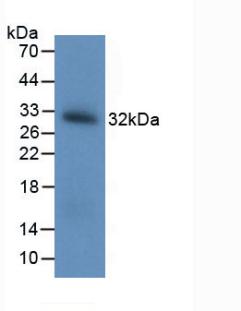 Polyclonal Antibody to Brain Derived Neurotrophic Factor (BDNF)