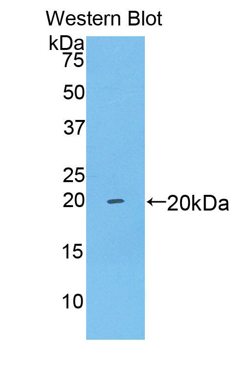 Polyclonal Antibody to Brain Derived Neurotrophic Factor (BDNF)