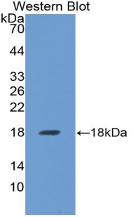 Polyclonal Antibody to Bone Morphogenetic Protein Receptor 1A (BMPR1A)