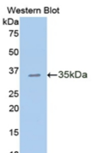 Polyclonal Antibody to E-cadherin