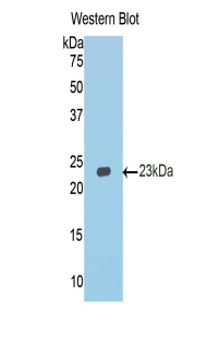 Polyclonal Antibody to E-cadherin