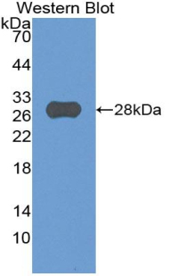 Polyclonal Antibody to Cluster Of Differentiation 33 (CD33)