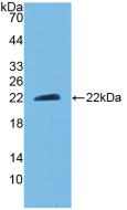 Polyclonal Antibody to Ciliary Neurotrophic Factor (CNTF)