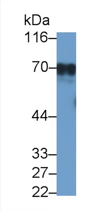 Polyclonal Antibody to Erythropoietin Receptor (EPOR)