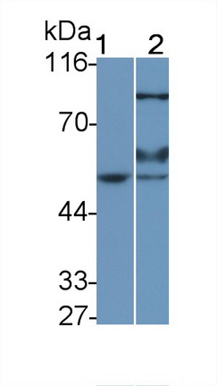 Polyclonal Antibody to Erythropoietin Receptor (EPOR)