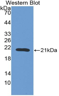 Polyclonal Antibody to Erythropoietin (EPO)