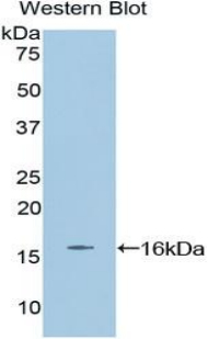 Polyclonal Antibody to Erythropoietin (EPO)