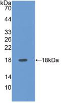 Polyclonal Antibody to E-selectin