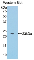 Polyclonal Antibody to Interferon Alpha (IFNa)