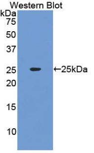 Polyclonal Antibody to Interferon Alpha (IFNa)