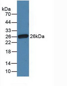 Polyclonal Antibody to Fibronectin (FN)