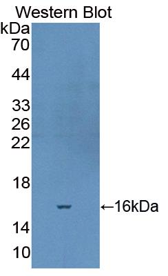 Polyclonal Antibody to Fibronectin (FN)