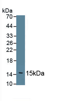 Polyclonal Antibody to Fibronectin (FN)