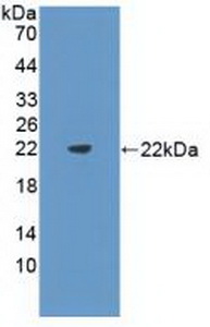 Polyclonal Antibody to FMS Like Tyrosine Kinase 3 Ligand (Flt3L)