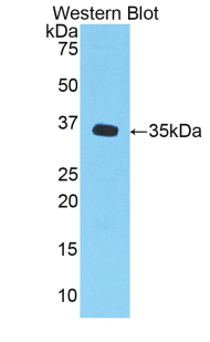 Polyclonal Antibody to Chemokine (C-X-C Motif) Ligand 1 (CXCL1)