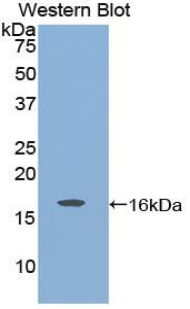 Polyclonal Antibody to Glial Cell Line Derived Neurotrophic Factor (GDNF)