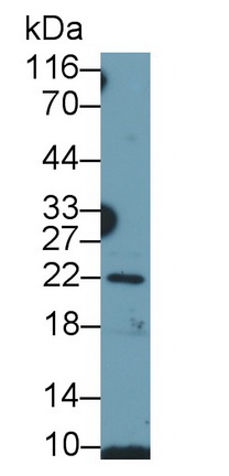 Polyclonal Antibody to Growth Hormone (GH)