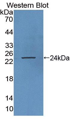 Polyclonal Antibody to Growth Hormone (GH)