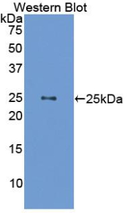 Polyclonal Antibody to Growth Hormone (GH)