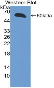 Polyclonal Antibody to Inhibin Beta E (INHbE)