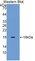 Polyclonal Antibody to Interferon Gamma (IFNg)