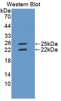 Polyclonal Antibody to Interferon Gamma (IFNg)