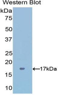 Polyclonal Antibody to Interferon Gamma (IFNg)