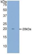 Polyclonal Antibody to Interferon Gamma (IFNg)