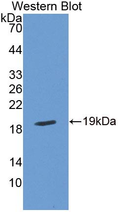 Polyclonal Antibody to Interferon Gamma (IFNg)