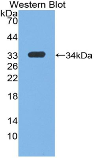 Polyclonal Antibody to Insulin Like Growth Factor 1 (IGF1)