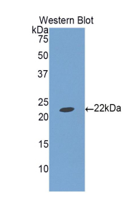 Polyclonal Antibody to Insulin Like Growth Factor Binding Protein 1 (IGFBP1)