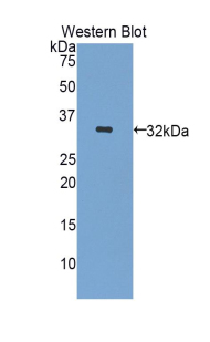 Polyclonal Antibody to Insulin Like Growth Factor Binding Protein 1 (IGFBP1)