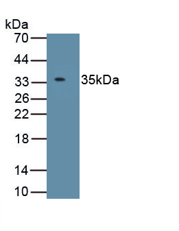 Polyclonal Antibody to Insulin Like Growth Factor Binding Protein 2 (IGFBP2)