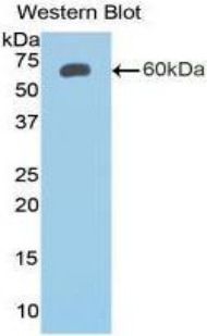 Polyclonal Antibody to Insulin Like Growth Factor Binding Protein 2 (IGFBP2)