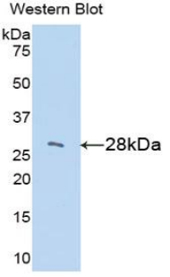 Polyclonal Antibody to Insulin Like Growth Factor Binding Protein 2 (IGFBP2)