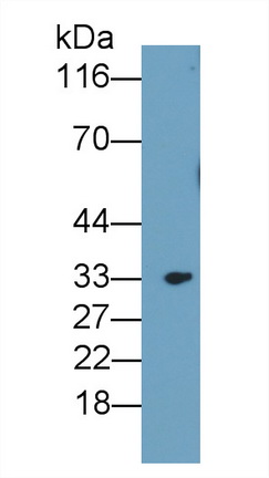 Polyclonal Antibody to Insulin Like Growth Factor Binding Protein 3 (IGFBP3)