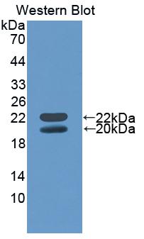 Polyclonal Antibody to Insulin Like Growth Factor Binding Protein 3 (IGFBP3)