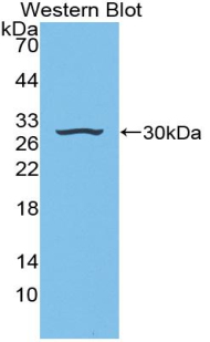 Polyclonal Antibody to Insulin Like Growth Factor Binding Protein 4 (IGFBP4)