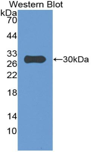 Polyclonal Antibody to Insulin Like Growth Factor Binding Protein 4 (IGFBP4)