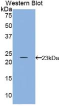 Polyclonal Antibody to Interleukin 10 (IL10)