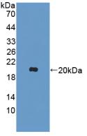 Polyclonal Antibody to Interleukin 10 (IL10)