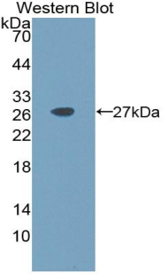 Polyclonal Antibody to Interleukin 11 (IL11)