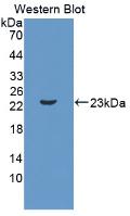 Polyclonal Antibody to Interleukin 11 (IL11)