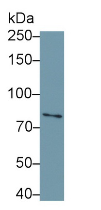 Polyclonal Antibody to Interleukin 1 Receptor Type I (IL1R1)