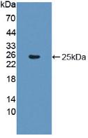 Polyclonal Antibody to Glial Fibrillary Acidic Protein (GFAP)