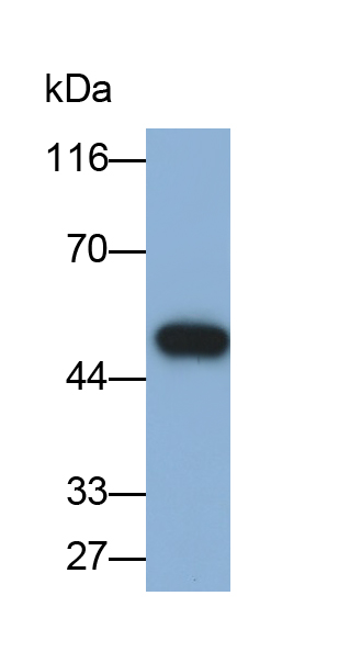 Polyclonal Antibody to Glial Fibrillary Acidic Protein (GFAP)